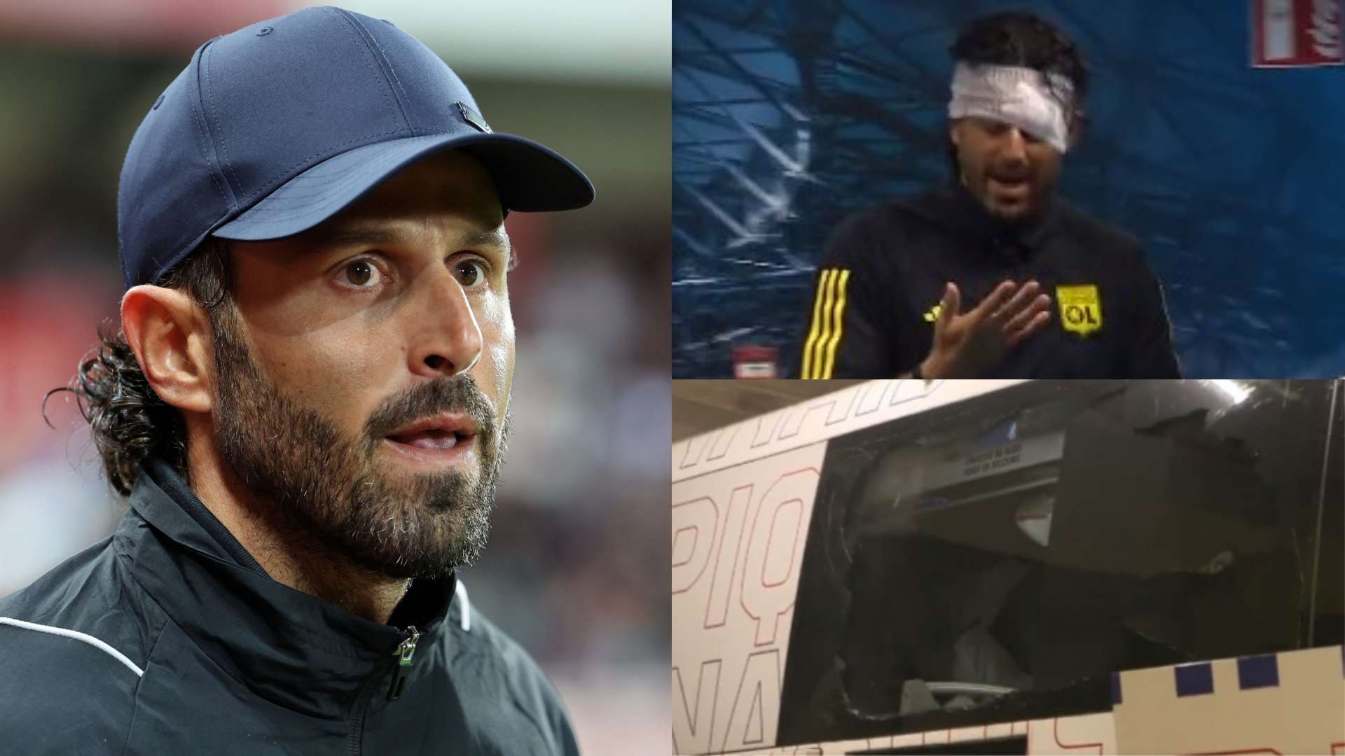 Fabio Grosso Lyon bus injury