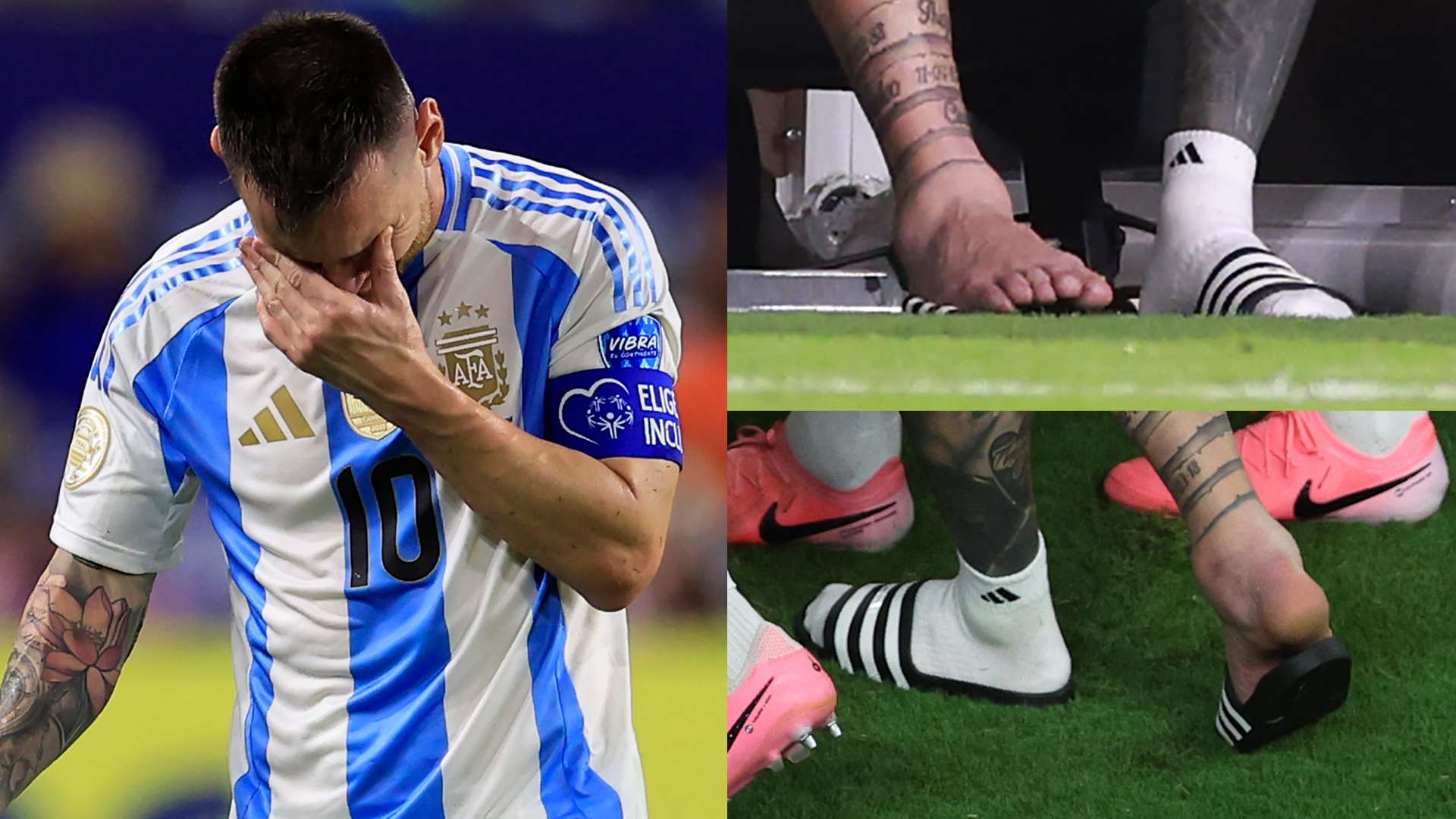 Lionel Messi ankle Copa America 2024