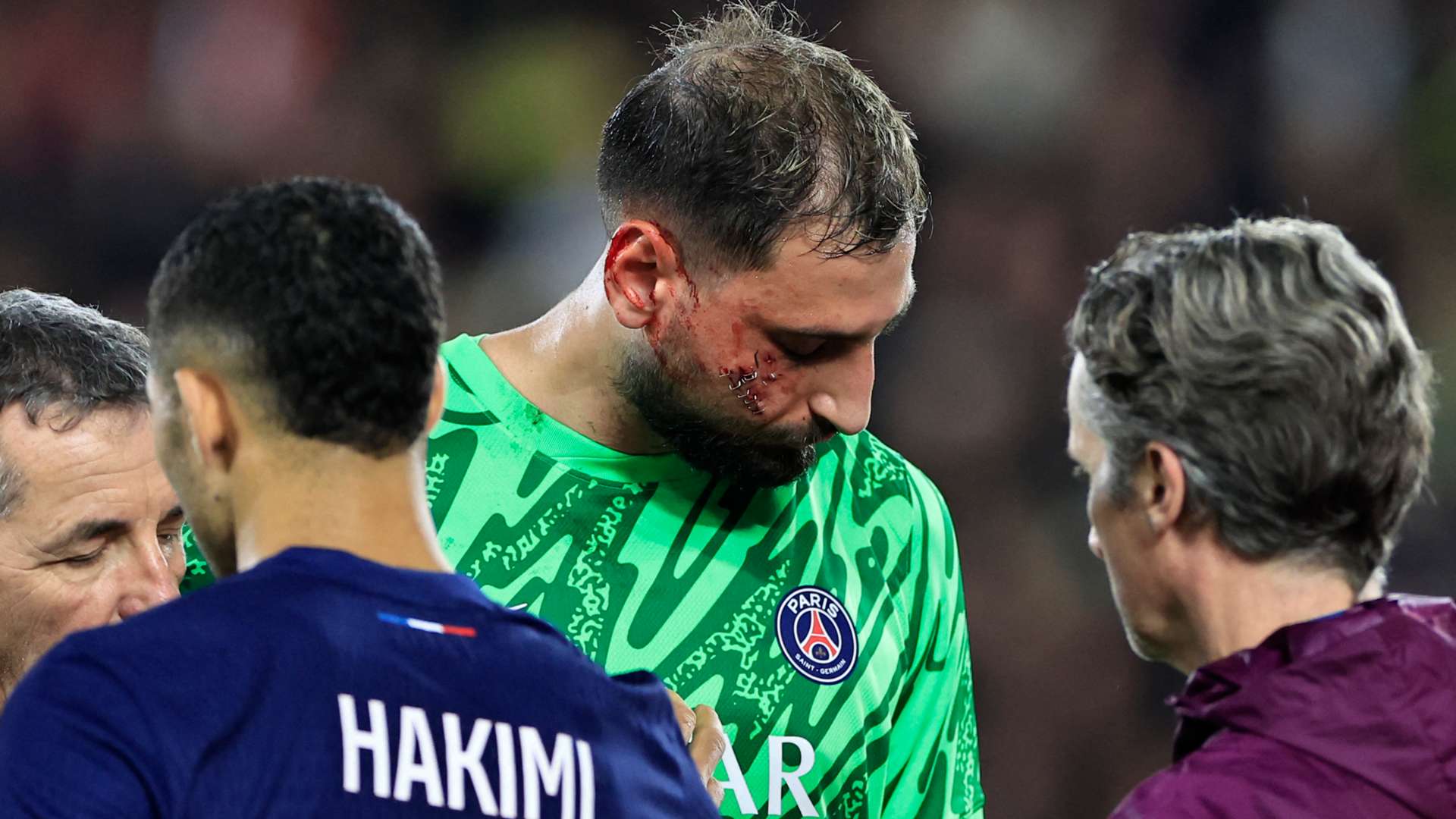 Gianluigi Donnarumma face injury PSG 2024-25